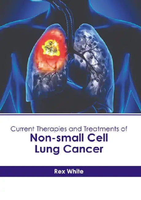 Current Therapies and Treatments of Non-Small Cell Lung Cancer by Rex White