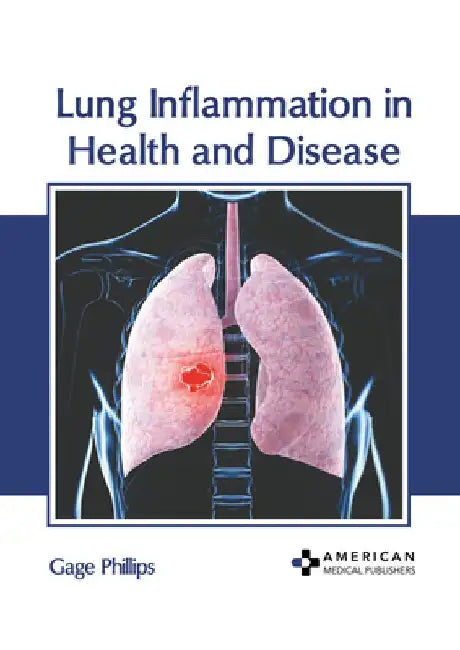 Lung Inflammation in Health and Disease by Gage Phillips