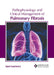 Pathophysiology and Clinical Management of Pulmonary Fibrosis by Liam Lawrence