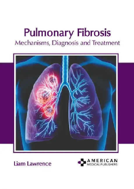 Pulmonary Fibrosis: Mechanisms, Diagnosis and Treatment by Liam Lawrence