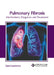 Pulmonary Fibrosis: Mechanisms, Diagnosis and Treatment by Liam Lawrence