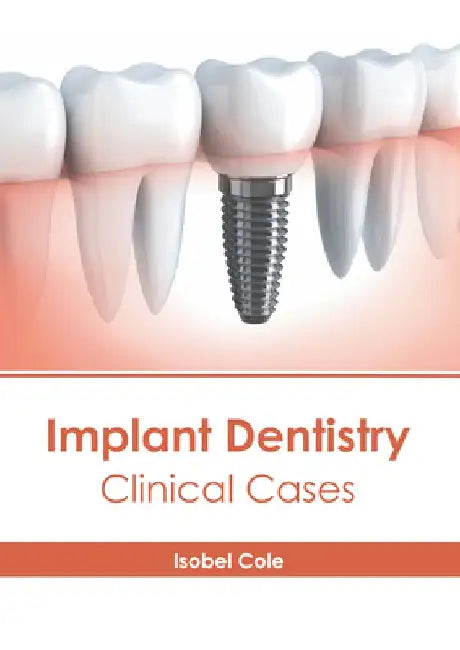 Implant Dentistry: Clinical Cases by Isobel Cole