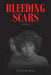 Bleeding Scars by Sunshine Myra