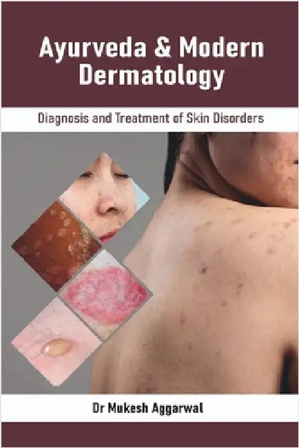 Ayurveda & Modern Dermatology: Diagnosis and Treatment of Skin Disorders by Dr Mukesh Aggarwal