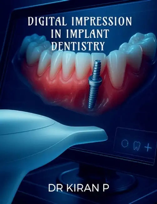 Digital Impression in Implant Dentistry by Dr Kiran P