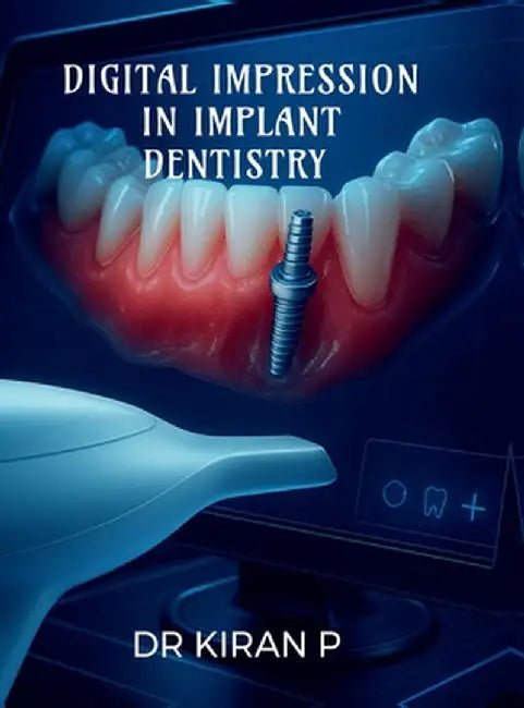 Digital Impression in Implant Dentistry by Dr Kiran P