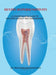 Dentin Hypersensitivity: A Comprehensive Guide to Pathophysiology and Management by Dr Pratheeba Ramamoorthy