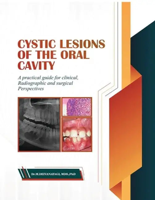 Cystic Lesions of the Oral Cavity: A Practical Guide for Clinical, Radiographic and Surgical Perspectives by Dr Deivanayagi M