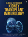 Clinical Textbook of Kidney Transplant Immunology by Manish Balwani