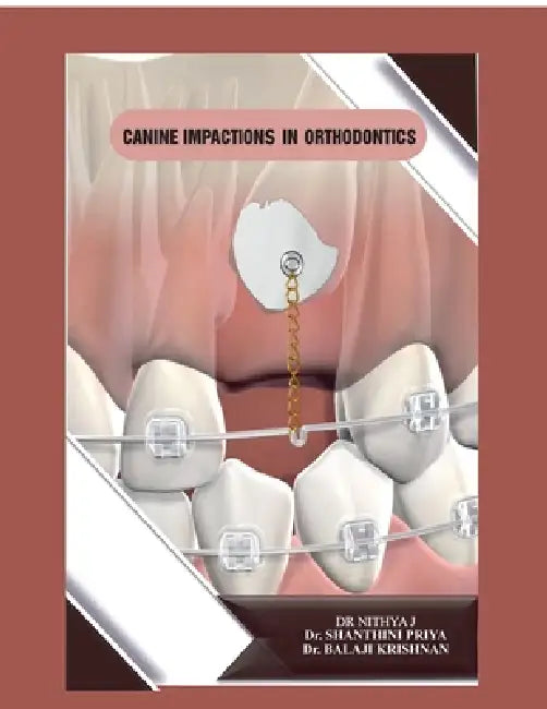 Canine Impactions in Orthodontics by Dr Nithya J., Dr Shanthini Priya, Dr Balaji Krishnan