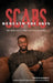 Scars Beneath the Skin by Smith Paul