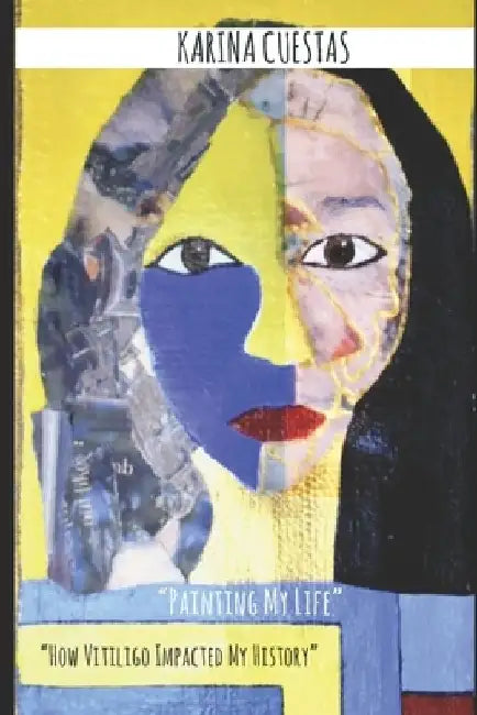 " Painting My Life" " How Vitiligo Impacted my history." by Karina Cuestas
