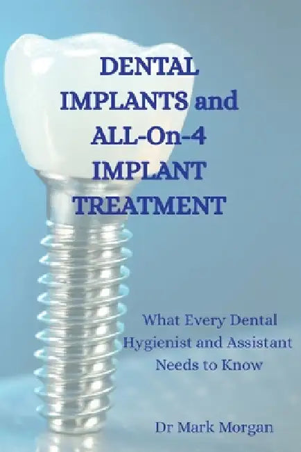 Dental Implants and All-On-4 Implant Treatment: What Every Dental Hygienist and Assistant Needs to Know by Mark Morgan